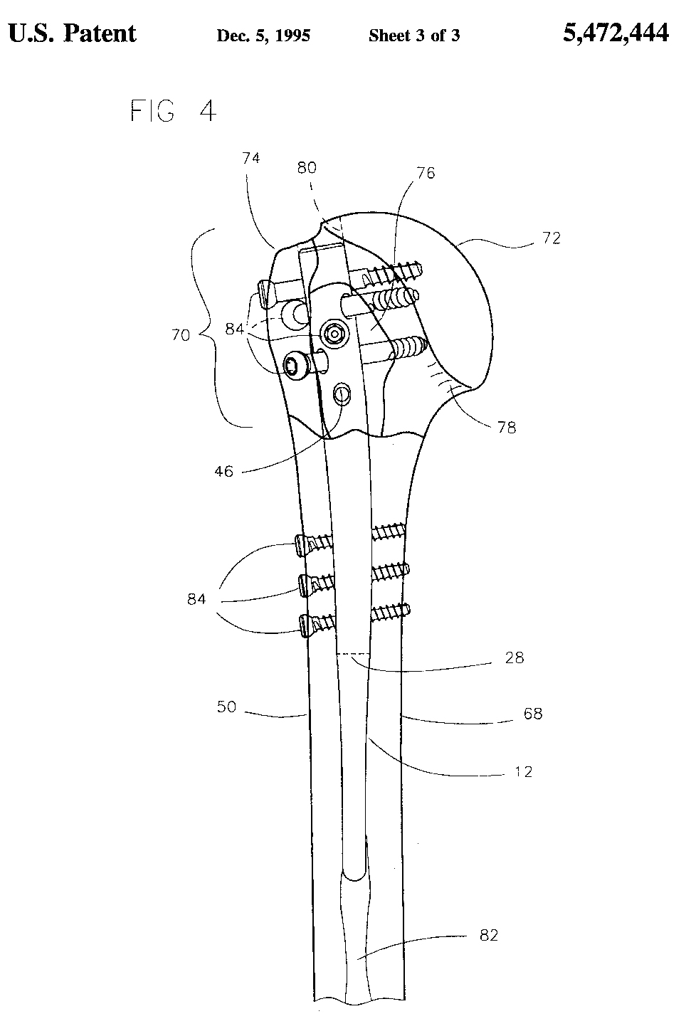 444特許の図3及び図4を示す説明図